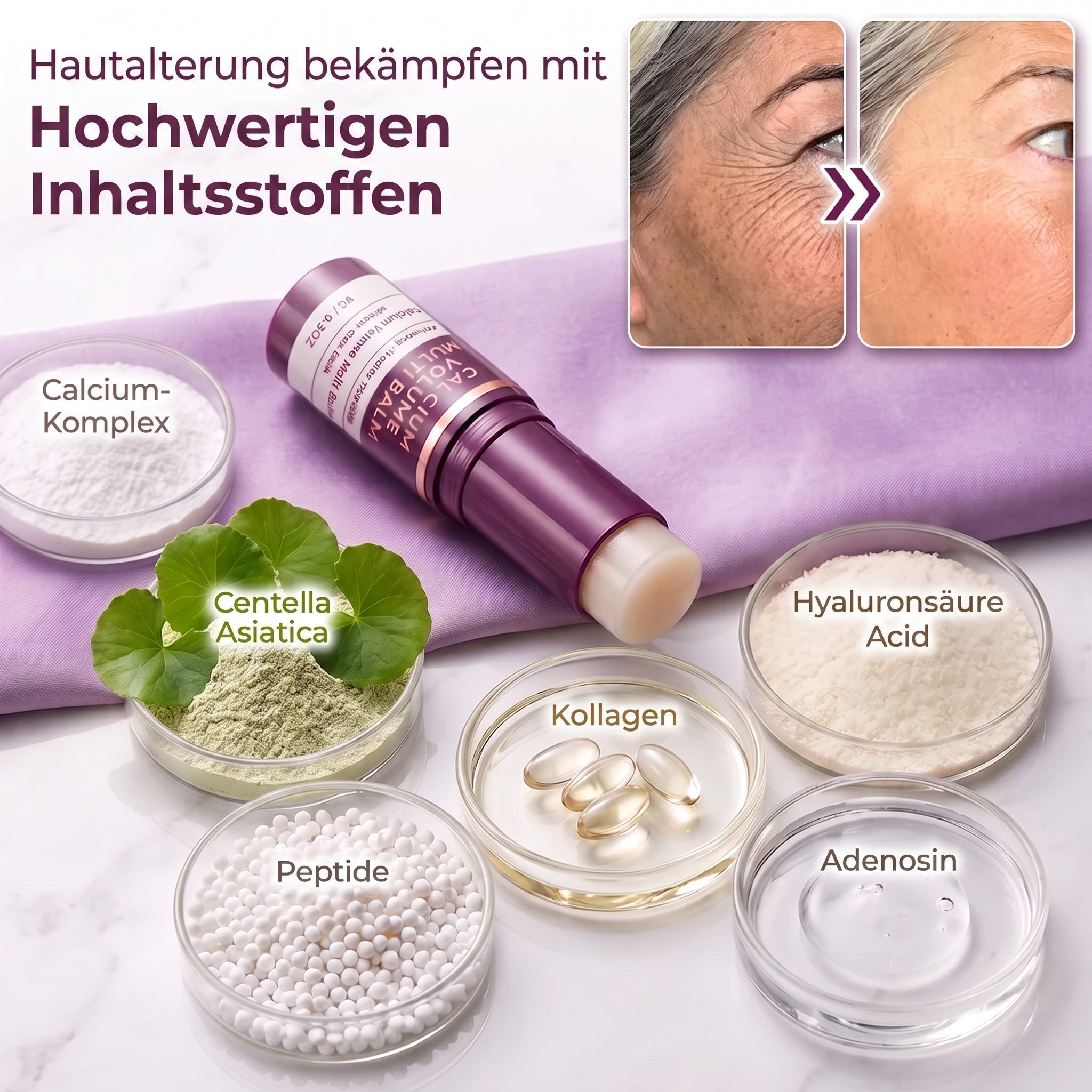 Natravor® Calcium Volumen Botox Balsam (KRHD)